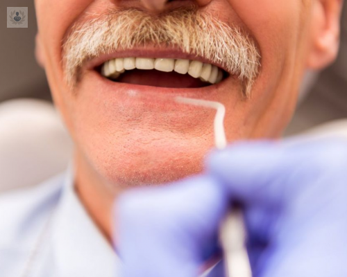 La solución para la perdida de dientes, las Prótesis Dentales