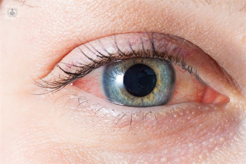 Recomendaciones básicas para el cuidado de los ojos
