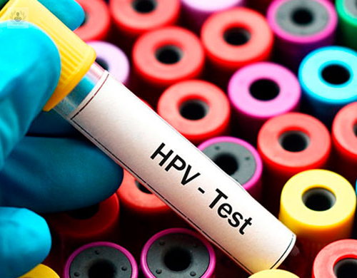 primeros-sintomas-y-tratamiento-del-virus-del-papiloma-humano imagen de artículo