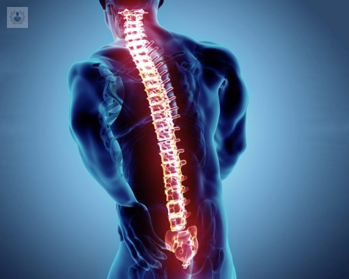 que-es-una-enfermedad-degenerativa-de-la-columna-vertebral imagen de artículo