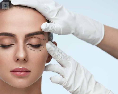 riesgos-y-cuidados-de-la-blefaroplastia imagen de artículo