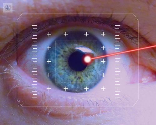 Cirugía Láser Ocular, ¿Qué es y cuáles son sus alternativas?
