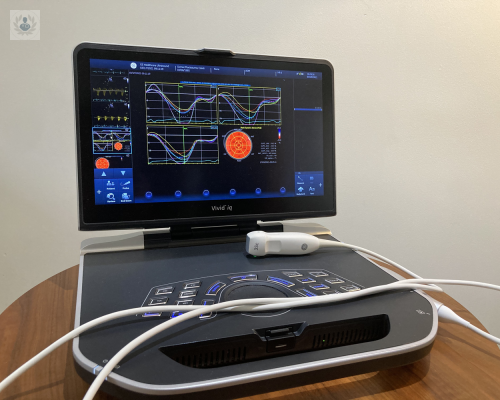 ecocardiograma-transtoracico-que-es-y-cual-es-su-precio imagen de artículo