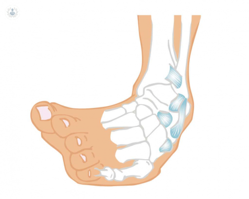 inestabilidad-ligamentaria-del-tobillo-que-es-y-como-tratarla imagen de artículo