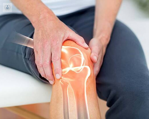 artroscopia-y-protesis-de-rodilla-que-opcion--elegir imagen de artículo