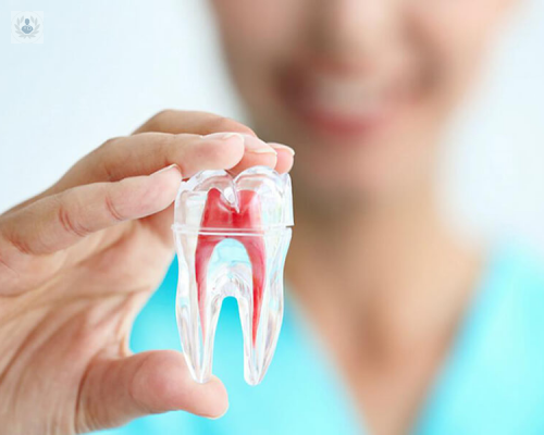 ¿Para qué sirve la endodoncia, qué trata y cómo funciona?