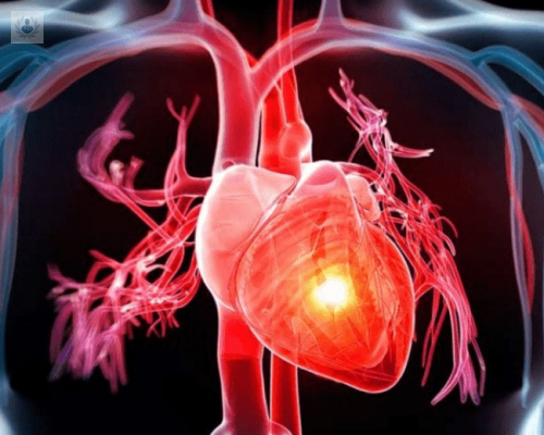 cardiologia-intervencionista-la-especialidad-de-las-enfermedades-del-corazon imagen de artículo
