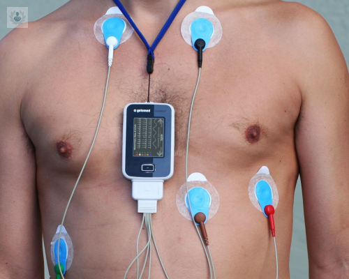 ¿Para qué sirve el Monitoreo Holter?