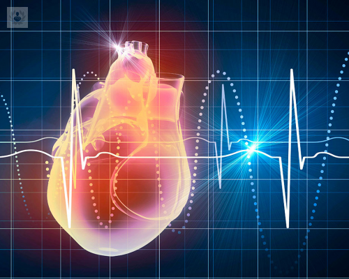 ¿Qué es un Electrocardiograma y para qué sirve?