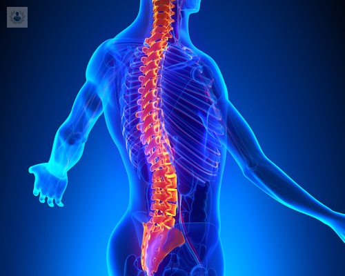 Cirugía de Columna Lumbar: qué es, síntomas y tratamiento