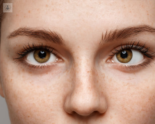 estrabismo-afectaciones-y-sintomas-de-la-enfermedad imagen de artículo