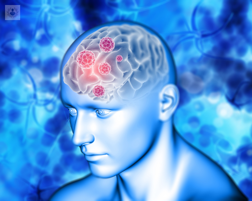 ¿Cómo se clasifica la Neuralgia del trigémino? Diagnóstico y tratamiento