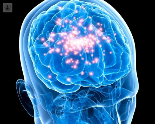 cirugia-de-epilepsia-que-es-y-quienes-pueden-ser-candidatos imagen de artículo