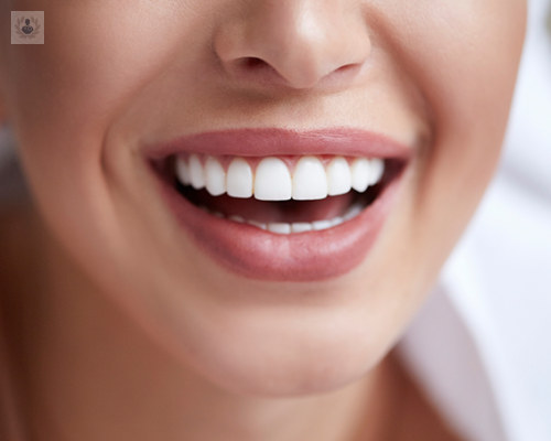 que-es-el-diseno-de-la-sonrisa imagen de artículo