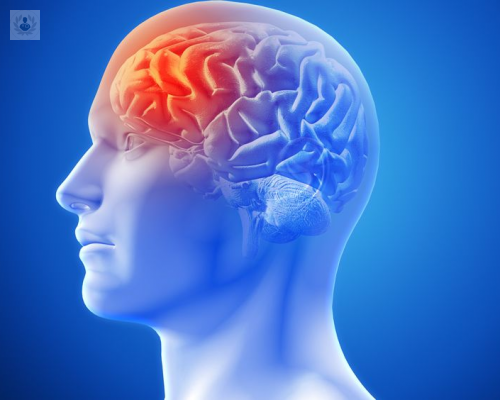 Tumor Cerebral: síntomas y tratamiento