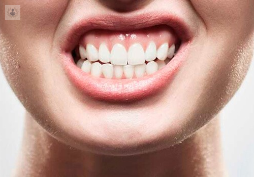 Bruxismo, un problema dental que va en aumento 