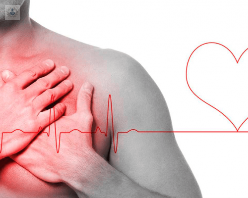 Cardiopatía Isquémica: causas, síntomas y tratamiento