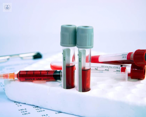 que-es-la-hematologia-y-cual-es-su-importancia imagen de artículo