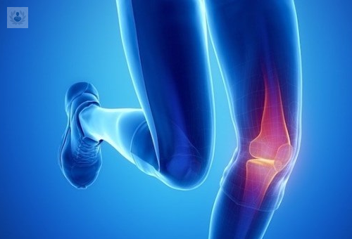 ejercicio-la-mejor-manera-de-prevenir-una-lesion-o-ruptura-del-ligamento-cruzado-anterior imagen de artículo