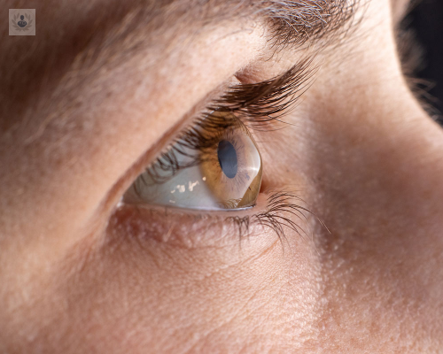 queratocono-una-enfermedad-multifactorial-degenerativa-de-la-cornea imagen de artículo