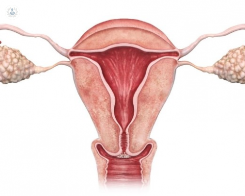¿Qué es la Displasia Cervical y cuál es su tratamiento?