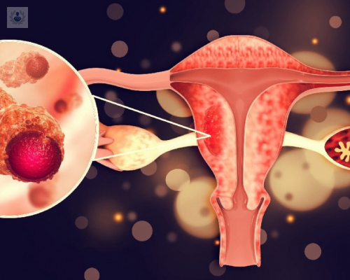 virus-del-papiloma-humano-todo-lo-que-debes-de-saber-de-esta-enfermedad imagen de artículo