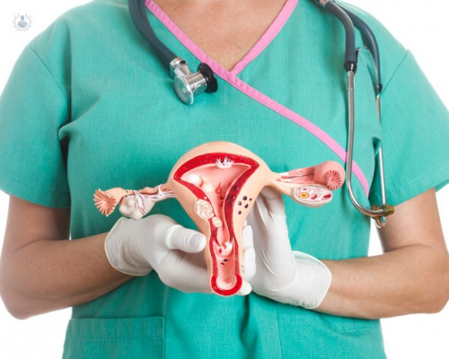 quistes-de-ovario-se-pueden-prevenir imagen de artículo