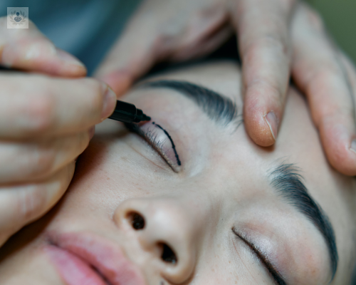 blefaroplastia-rejuvenece-tu-mirada-en-poco-tiempo imagen de artículo