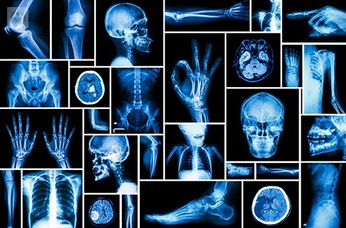 Explorando el mundo de la Radiología: ¿Qué es y para qué sirve?