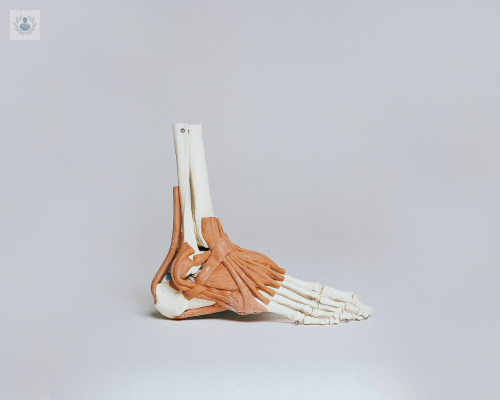 rehabilitacion-de-fascitis-plantar imagen de artículo