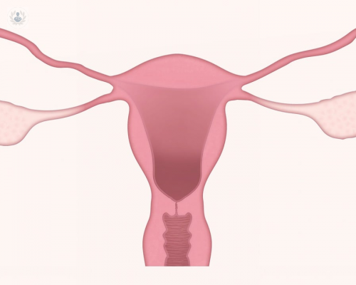 Menopausia: ¿es necesario tratamiento hormonal?