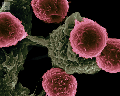 genetica-y-genomica-del-cancer-de-mama-una-mirada-profunda-a-la-enfermedad imagen de artículo