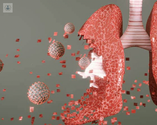 bronquiectasias-que-son-y-como-se-tratan imagen de artículo