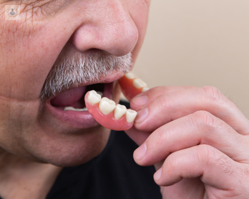Prótesis dental: Tipos y funciones