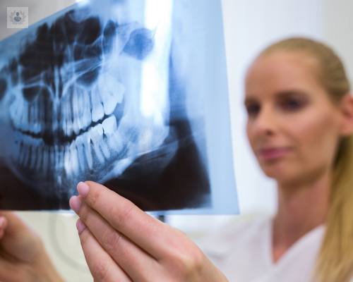 Cirugía Ortognática y sus beneficios en la salud bucal