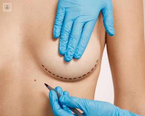 cirugia-de-aumento-de-mama-con-implantes-beneficios-y-precauciones imagen de artículo