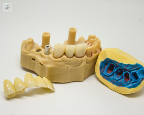 maloclusiones-como-afectan-tus-dientes-y-encias imagen de artículo