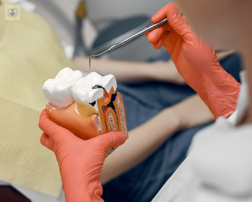 Odontología Preventiva: Previene enfermedades bucales desde los 0 hasta los 100 años
