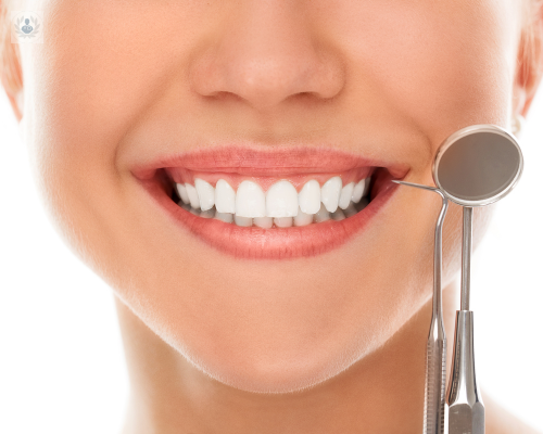 Blanqueamiento Dental: restaura el brillo de tu sonrisa