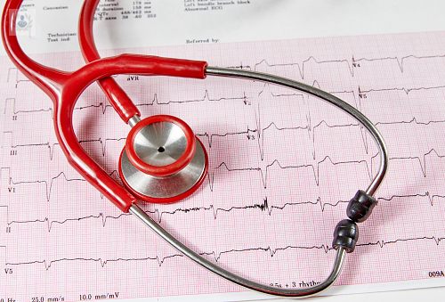 Ecocardiograma: Un estudio para el corazón