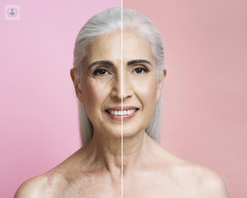 fotorejuvenecimiento-con-luz-pulsada-tratamiento-antiedad-de-la-piel imagen de artículo