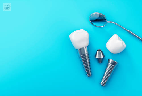 Implantes Dentales: Una mini cirugía oral