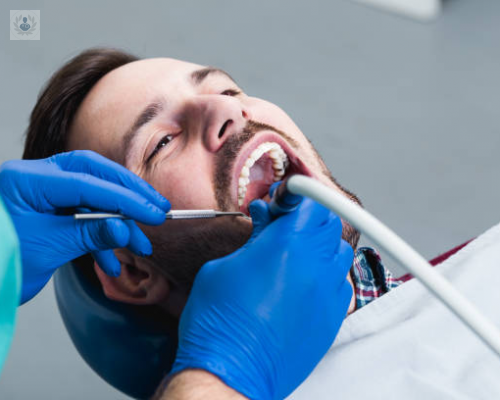 carillas-y-coronas-para-una-sonrisa-perfecta imagen de artículo