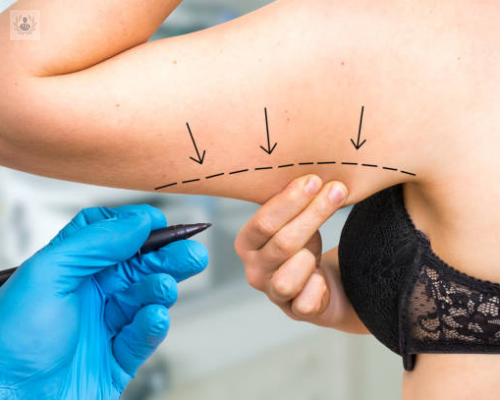 cirugia-de-contorno-corporal-conoce-de-este-procedimiento-estetico imagen de artículo