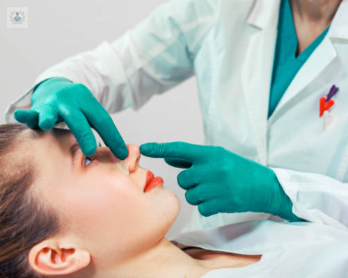 rinoplastia-conoce-como-moldear-las-estructuras-nasales imagen de artículo