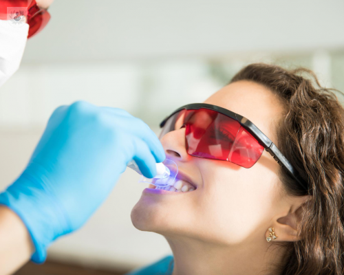 blanqueamiento-dental-es-posible-hacerlo-en-casa imagen de artículo