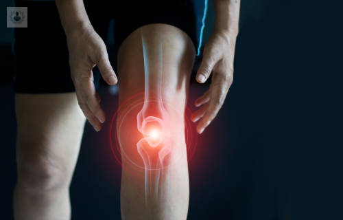 Rodilla: qué es, síntomas y tratamiento