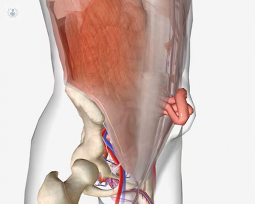 hernia-inguinal-que-cirugias-existen-para-tratarla imagen de artículo