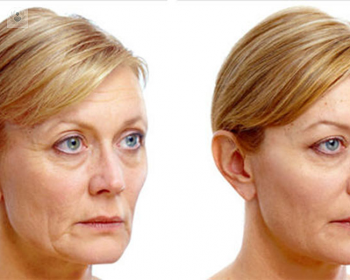 tratamiento-antiaging-opcion-para-retrasar-la-aparicion-de-los-signos-de-la-edad imagen de artículo