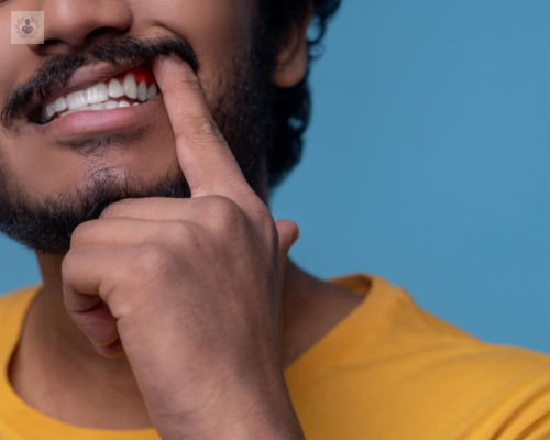 enfermedad-periodontal-por-que-no-debes-cepillar-tus-dientes-hasta-sangrar imagen de artículo